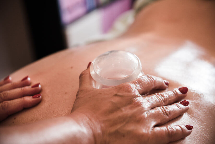 Cuppingmassage Cuppingmassage